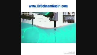 جراحی ستون فقرات