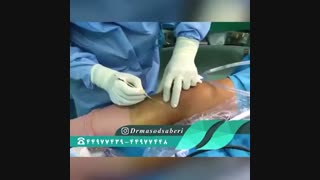 منظور از عمل رباط صلیبی به صورت بسته(لیزری) چیست؟ | دکتر مسعود صابری متخصص ارتوپد پروتز دندان
