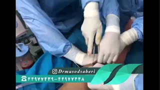 وسایل عمل در جراحی رباط صلیبی چه کاربردی دارند؟