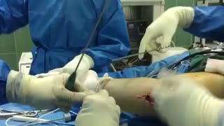 بازسازى رباط صلیبى