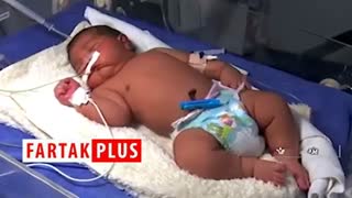 تولد سنگین وزن‌ترین نوزاد ایران در یزد