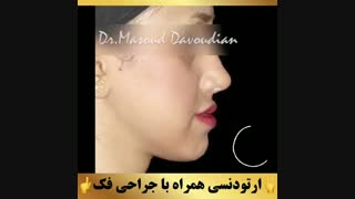 ارتودنسی تهران | دکتر داوودیان