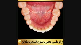 ارتودنسی غرب تهران | دکتر داوودیان