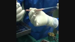 بازسازی رباط صلیبی و آرتروسکوپی زانو