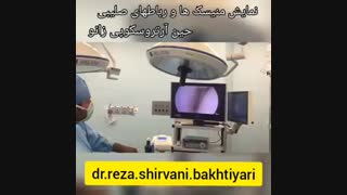 جراحی آرتروسکوپی زانو