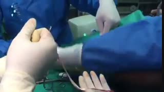 جراحی آرتروسکوپیک بازسازی رباط صلیبی