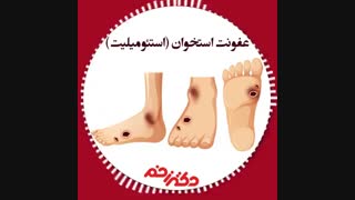 صحبت های دکتر جمال میرزایی در مورد عفونت استخوان