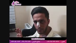 رضایت از بینی عمل شده ده روز پس از جراحی زیبایی توسط دکتر کاوان