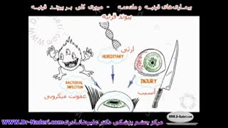 پیوند قرنیه - مرکز چشم پزشکی دکتر علیرضا نادری