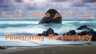 پیوند تمام ضخامت قرنیه - مرکز چشم پزشکی دکتر علیرضا نادری