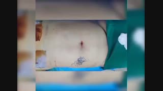 لیپوماتیک - دکتر ابدالی - 22807060