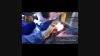 جراحی تومور صورت