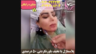 مادلینگ چهره با تزریق پلاسماژل