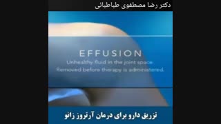 تزریق دارو برای درمان آرتروز زانو