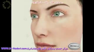 شالازیون - مرکز چشم پزشکی دکتر علیرضا نادری