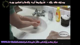 تمیز کردن لبه پلک ها با شامپو بچه - مرکز چشم پزشکی دکتر علیرضا نادری