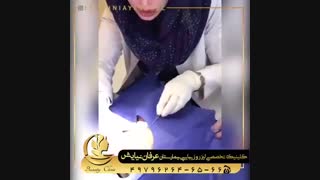 درمان جای جوش با سابسیژن پروتز دندان