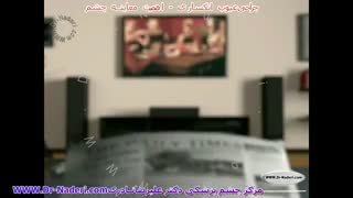 معاینات چشم در جراحی عیوب انکسار-مرکز چشم پزشکی دکتر علیرضا نادری