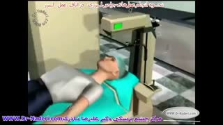 تکنیک انجام جراحی عیوب انکسار- مرکز چشم پزشکی دکتر علیرضا نادری