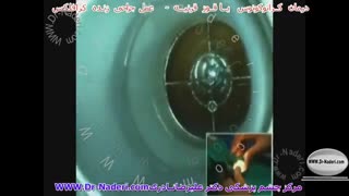 جراحی کرافلکس - مرکز چشم پزشکی دکتر علیرضا نادری