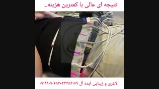 لاغری موضعی سریع با لیزر کم توان لاغری
