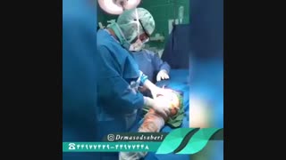 علت آرتروز زانو و جراحی در سن پایین؟