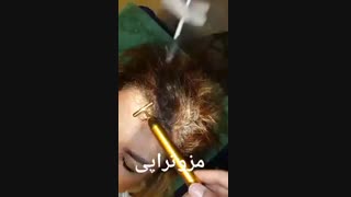 مزوتراپی - 22807060