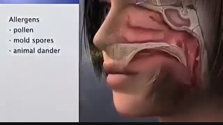 نحوه شستشوی بینی