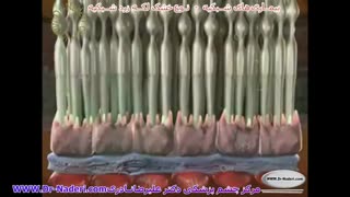 نوع خشک تخریب سنی لکه زرد شبکیه-مرکزچشم پزشکی دکتر علیرضا نادری