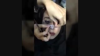 چسب زدن به بینی بعد از جراحی