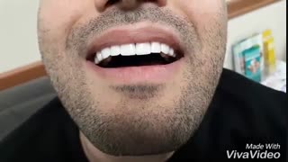 دندانپزشکی نسیم قیطریه-درمانگاه نسیم قیطریه-لمینت –کامپوزیت-ونیر-ارتودنسی-ایمپلنت-کاشت دندان