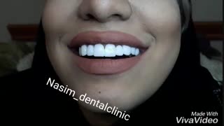 دندانپزشکی نسیم قیطریه-درمانگاه نسیم قیطریه-لمینت –کامپوزیت-ونیر-ارتودنسی-ایمپلنت-کاشت دندان