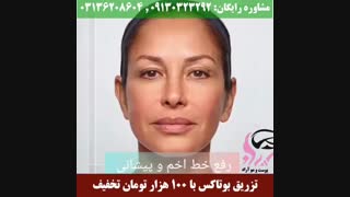 تزریق بوتاکس