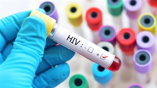 هر آنچه لازم است در مورد ویروس ایدز (HIV) بدانید