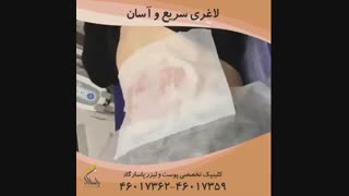 لاغری سریع آسان در یک روز !