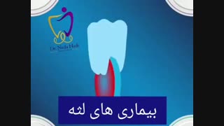 بیماری های لثه