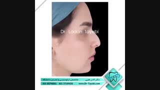درمان ارتدنسی به همراه جراحی فک | دکتر طیبی