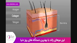 لیزر موهای زائد | فیلم لیزر موهای زائد | کلینیک پوست و مو نیل | شماره 3