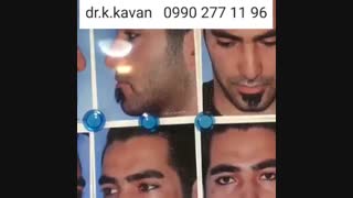 جراحی فانتزی و نیمه فانتزی توسط دکتر کاوان