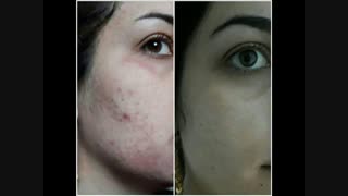 کرم دست ساز شب