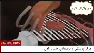 نحوه انجام سوگرافی کلیه