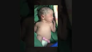 لحظه تولد نوزاد