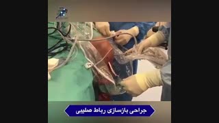 جراحی بازسازی رباط صلیبی زانو توسط دکتر رضا شیروانی درمان ریزش مو