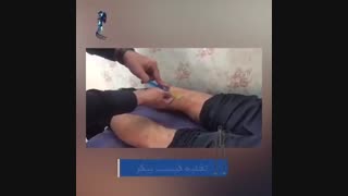 تشخیص و درمان کیست بیکر