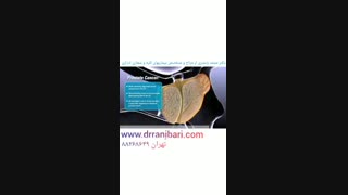 فیلم سرطان پروستات