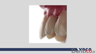 کامپوزیت VOCO - GRANDIO