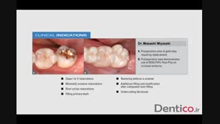 کامپوزیت SHOFU - Beautiful Flow Plus