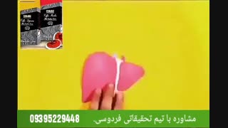 درمان قطعی کبد چرب با گانودرما