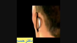 عملیه الاذن