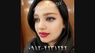 فیلم جراحی بینی توسط دکتر عباس نوروزی